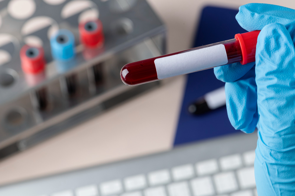 home-blood-test